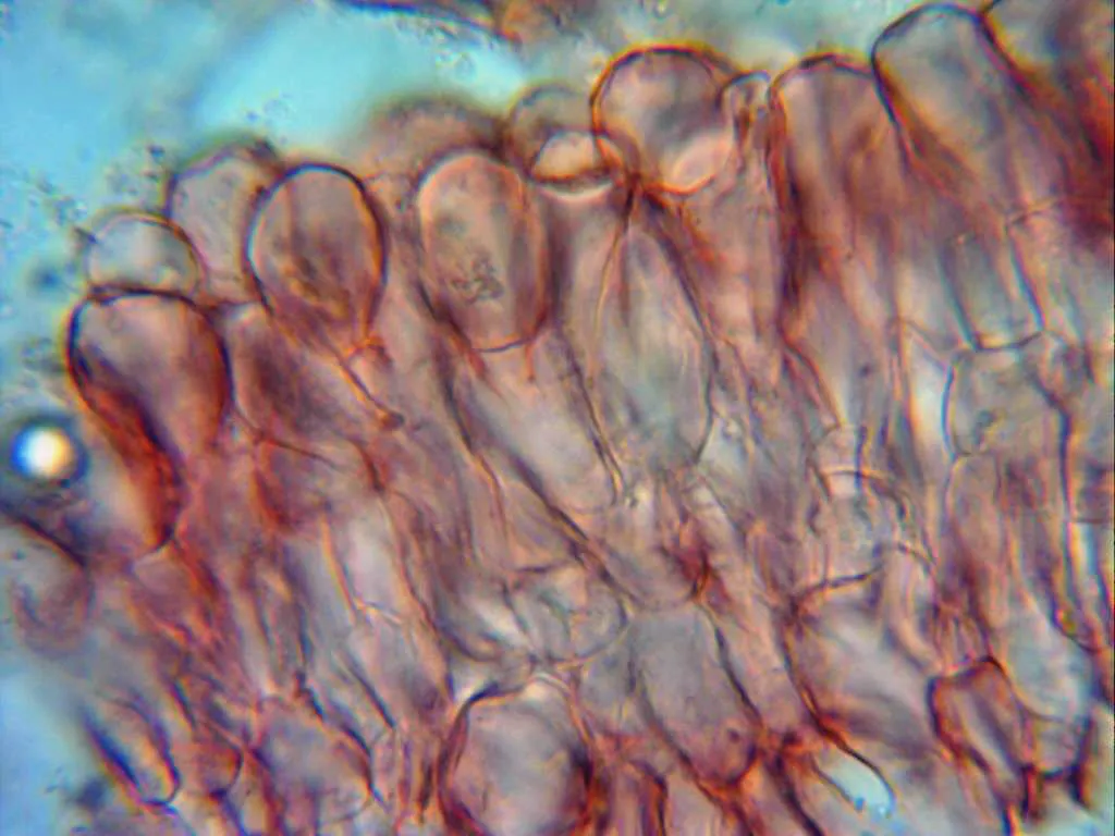 10 - Excípulo ectal